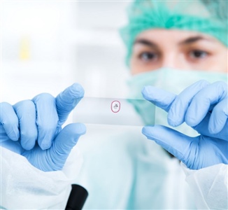 Tissue Biopsy